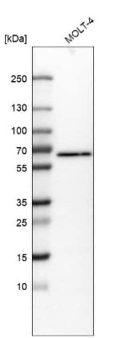 ACPL2 Antibody, Novus Biologicals:Antibodies:Primary Antibodies